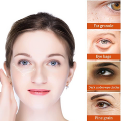 Milia Remover Essential